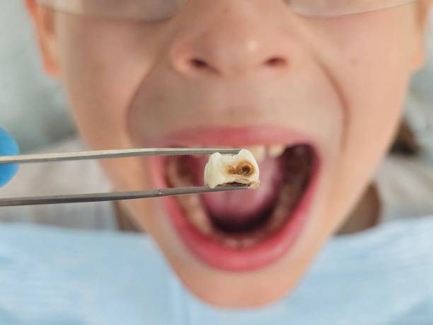 Best Urgent Dental Care for Toothache in Nixon, PA